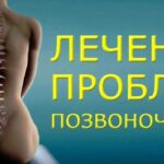 Эффективные способы лечения позвоночника: как вернуть здоровье спине